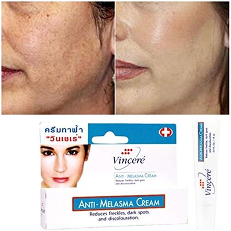 Anti Melasma Cream Shopping Online In Pakistan