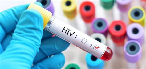 PICOS Casos De HIV Aumentam Mais De 100 Em 2019 Comparado Ao Ano