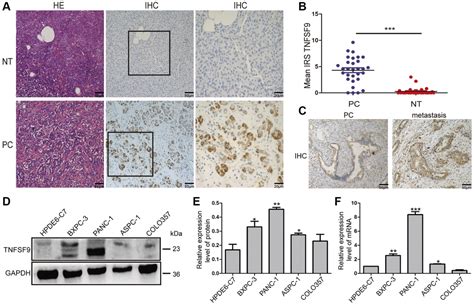 Tnfsf Promotes Metastasis Of Pancreatic Cancer Through Wnt Snail