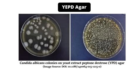 YEPD Agar Composition Principle Preparation Results Uses