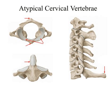 Atypical Cervical Vertebrae