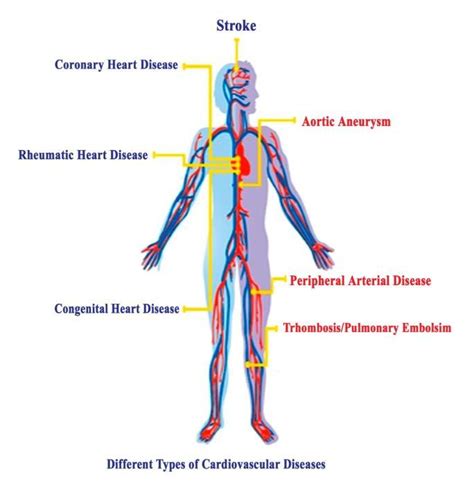 Collection 102 Images Types Of Heart Diseases With Pictures Stunning