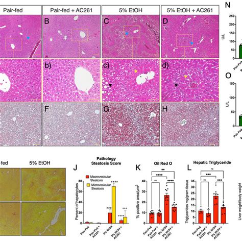 Treatment With AC261066 AC261 Mitigates Hepatic Steatosis And