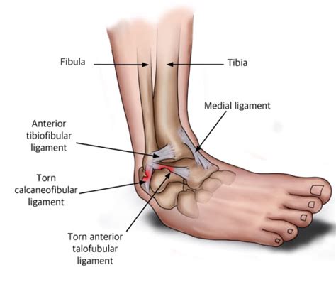 Posterior Ankle Ligaments