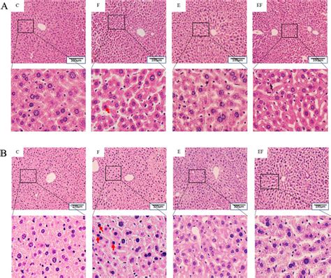 The He Staining Diagram Of The Liver In Mice From The Group C F E