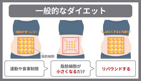 脂肪細胞は医療ダイエットで減らせる！自力で減らす方法はある？ ディオクリニック