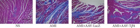 AAV Tβ4 alleviates ligation induced heart fibrosis in mice Detection