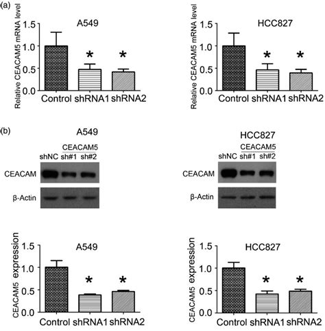 CEACAM5 Stimulates The Progression Of Non Small Cell Lung Cancer By