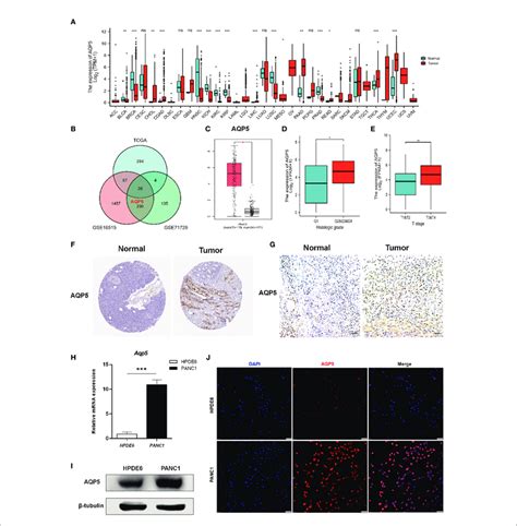 The Expression Of Gene AQP5 MRNA In Different Kinds Of Tumors And Its