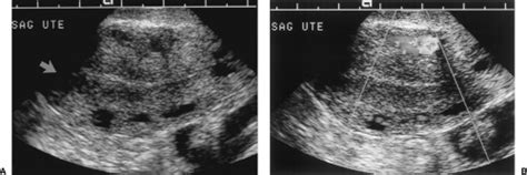 Female Pelvis Ultrasound Radiology Key