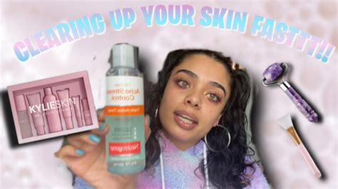 How To Clear Up Your Skin Fast Products And Tips Youtube