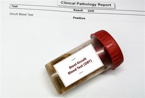 Premium Photo Occult Blood Test Obt With Abnormal Patient S Report