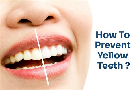 Prevent yellow teeth with Less brushing pressure on teeth - DentalDost