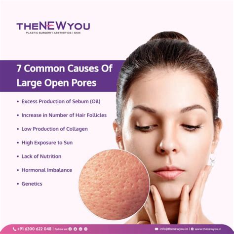 Open Pores Treatment In Hyderabad Safe And Advanced Techniques