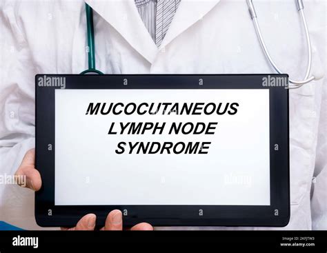 Mucocutaneous Lymph Node Syndrome Conceptual Image Stock Photo Alamy