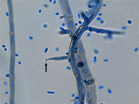 Fun With Microbiology What S Buggin You Pleruostomophora Richardsiae