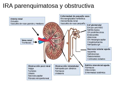 Insuficiencia Renal Aguda Nefrolog A Al D A