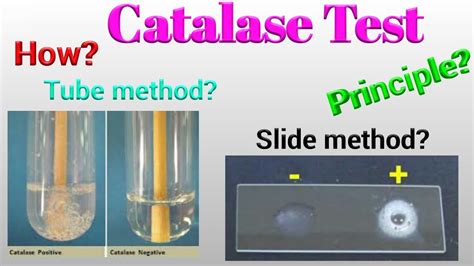 Catalase Test Principle Procedure Types Results Uses 55 Off