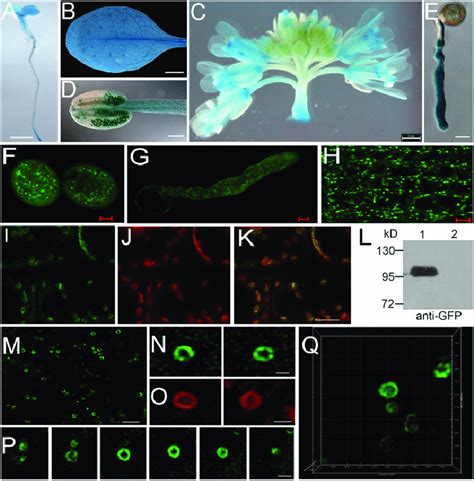 The Expression Pattern And Subcellular Localization Of LOT A E GUS