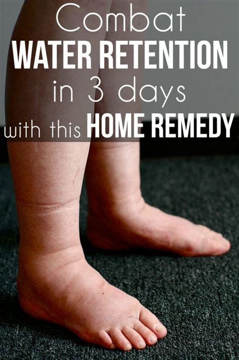 Water Retention In Ankles And Legs