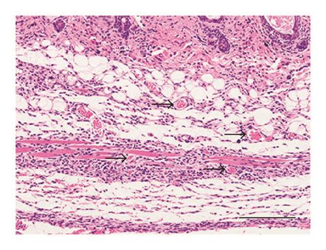 Vascularization And Immunofluorescence Staining Macroscopic