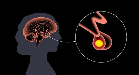 What Does The Pituitary Gland Do