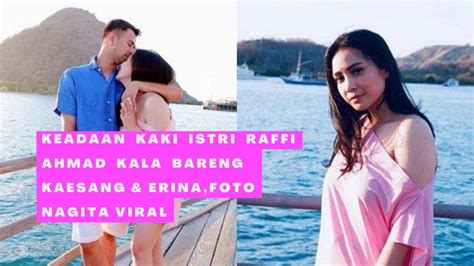 Keadaan Kaki Istri Raffi Ahmad Kala Bareng Kaesang Dan Erina Foto