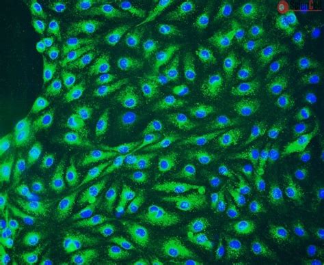 Human Lymphatic Endothelial Cells Hlec