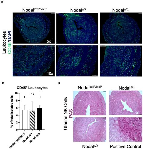 Frontiers Uterine Nodal Expression Supports Maternal Immunotolerance