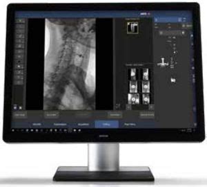 Software para radiologia Todos os fabricantes de equipamentos médicos