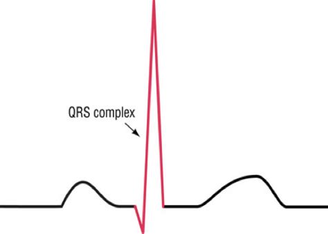 EKG Exam 1 Flashcards Quizlet