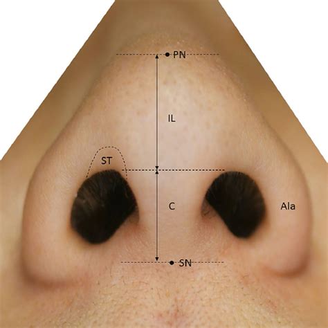 External Nose Anatomy