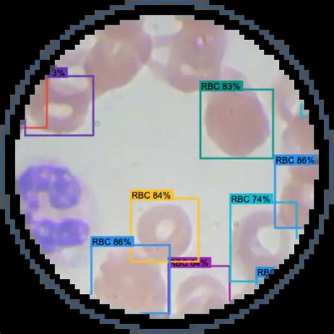 Case Study Cell Counting - Folio3 AI