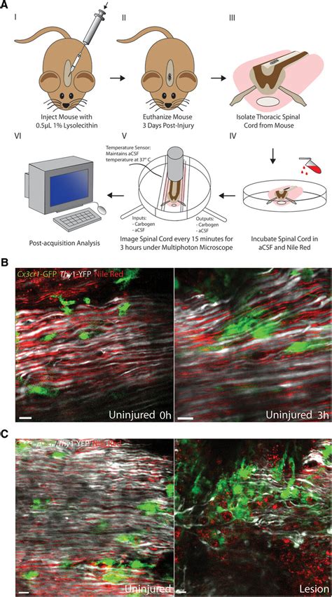 Ex Vivo Multiphoton Live Imaging Of A Demyelinated Dorsal Column In