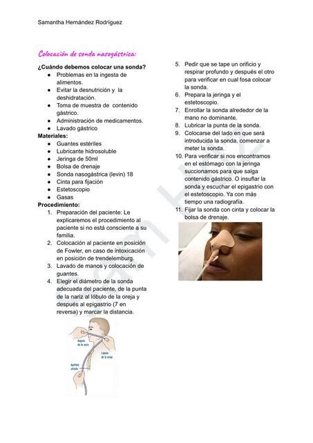 Colocación de sonda nasogástrica Samantha Hernández uDocz