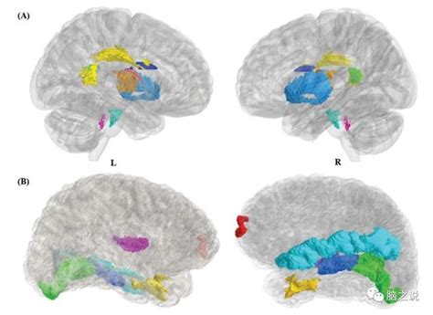 Schizophrenia Bulletin：利用多模态结构脑影像数据对首发精神分裂患者进行分类 知乎