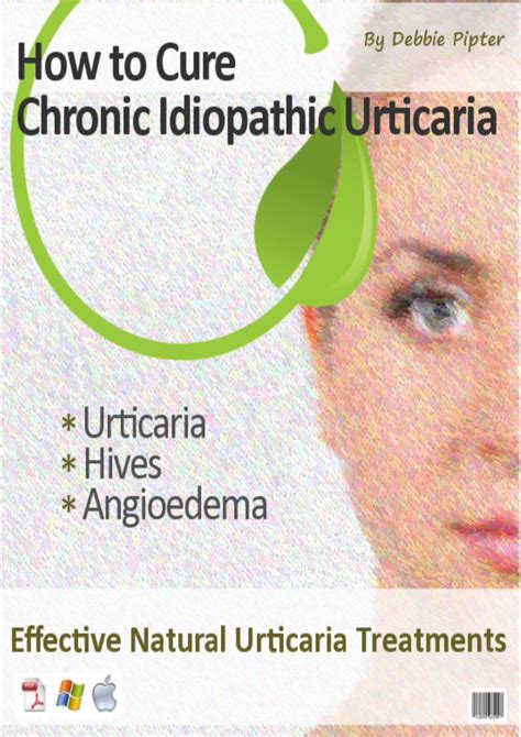 (PDF) Chronic Idiopathic Urticaria-How to Cure Idiopathic Urticaria ...