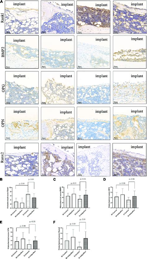 Proteins Of Rankl Bmp2 Opg Opn And Runx2 In Femoral Bone With