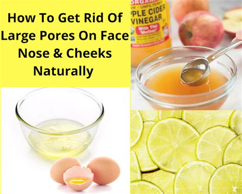 How To Get Rid Of Large Pores On Face Nose Cheeks Naturally Beauty And Lifestyle Mantra