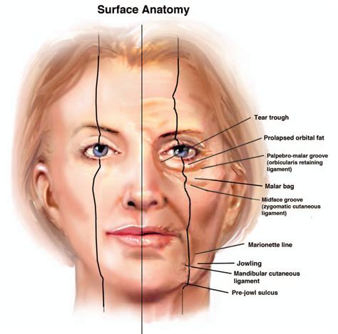 Aging face | Facial aesthetics, Facial contouring, Facial anatomy