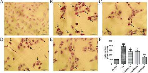 Effect Of As Iv On Lipid Deposition In Hk Cells Induced By Pa Oil