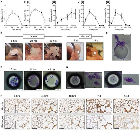 Frontiers Foreign Body Reaction To Implanted Biomaterials And Its Impact In Nerve Neuroprosthetics