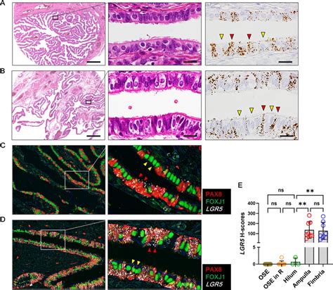 High Levels Of Lgr Expression In The Fallopian Tubes A Ampulla Of