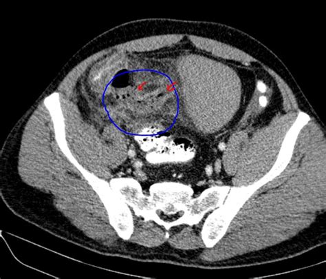 Image Radiopaedia Org