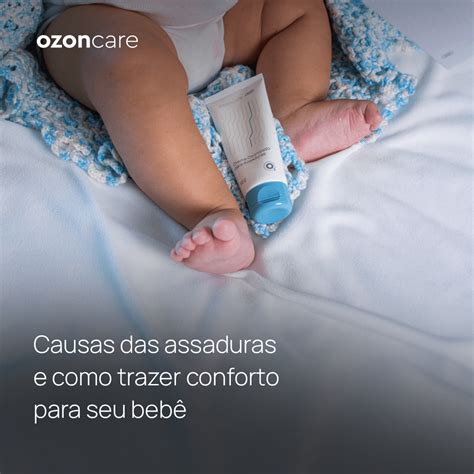 O Que Causa Assaduras No Bebe - Ozoncare - Causas das assaduras e como trazer conforto para seu bebê ...