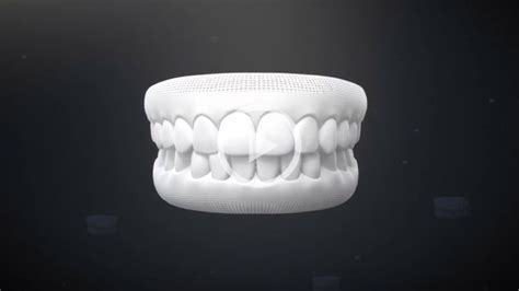 Braces And Invisalign In Midlothian Insurance Accepted