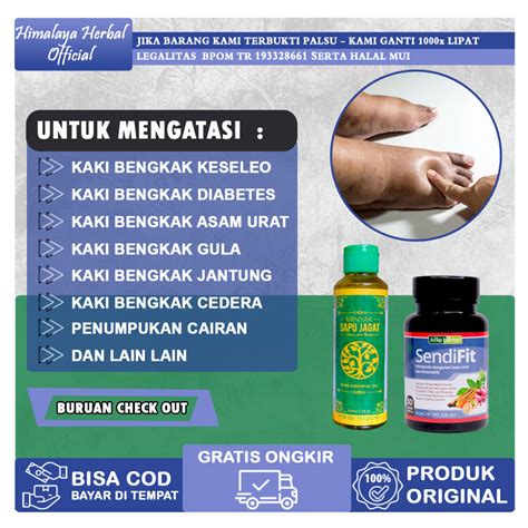 Jual Obat Kaki Bengkak Karena Keseleo Jatuh Diabetes Asam Urat Ginjal