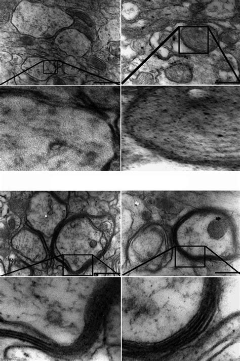 Transmission Electron Micrographs Of Shiverer Mice Brain Showing Thin