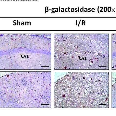 Effects Of Ict Treatment On The Expression Of Senescence Markers