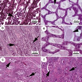 Microphotography Of Penaeus Vannamei Hepatopancreas Inoculated With